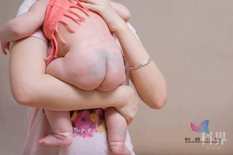 宝宝屁股有淤青的传说,新生宝宝屁股青民间说法