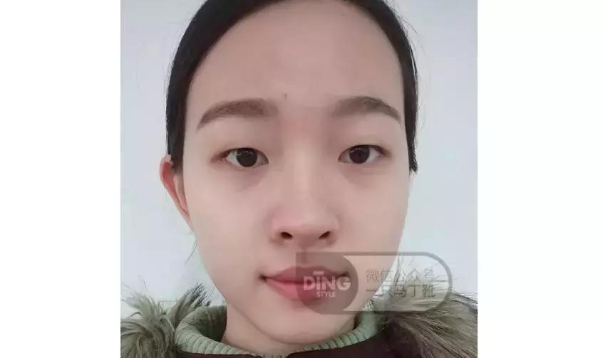 中庭又长又宽显老,中庭长怎么避免显老