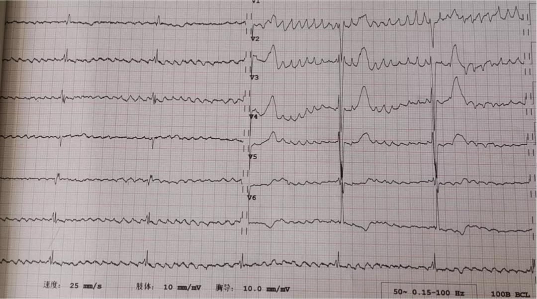 患者的治疗方案?患者的选择或是医生的选择,如何选择最优解?
