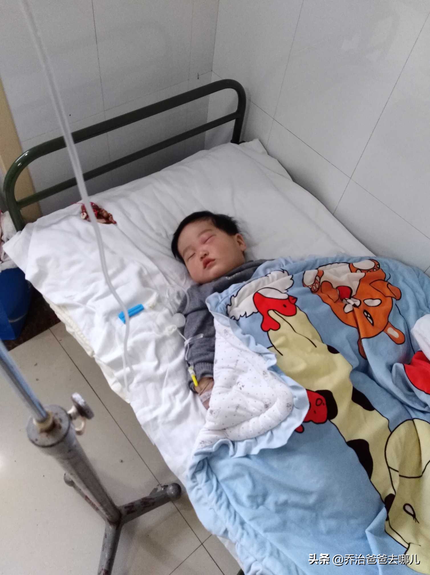 儿童面部急性蜂窝织炎如何诊断,宝宝救命的正确方法