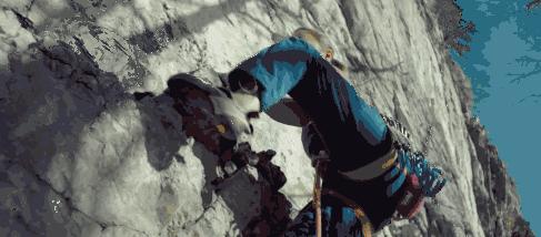 牙齿矫正后变黄怎么处理,矫正牙齿后牙齿为什么变黄了