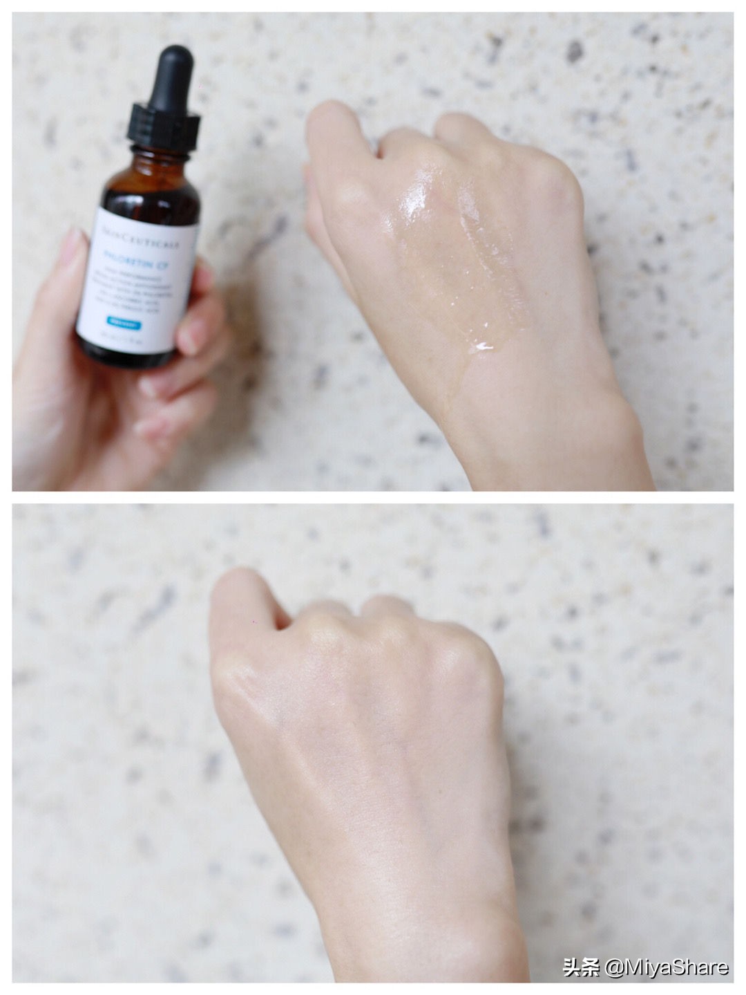 修丽可美白发光瓶和淡斑区别,修丽可美白发光精华适合油痘肌吗