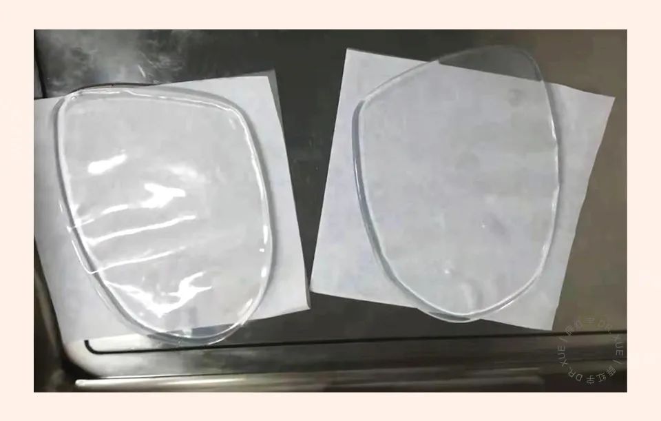 男性隆胸,男性隆胸后续