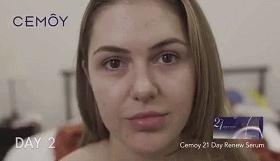 我的21天美容之路,我的养肤秘籍