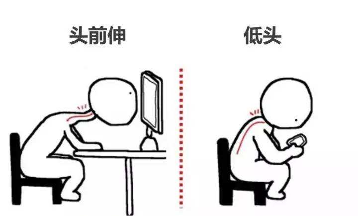 两个动作改善脖子不舒服,低头看手机脖子运动缓解