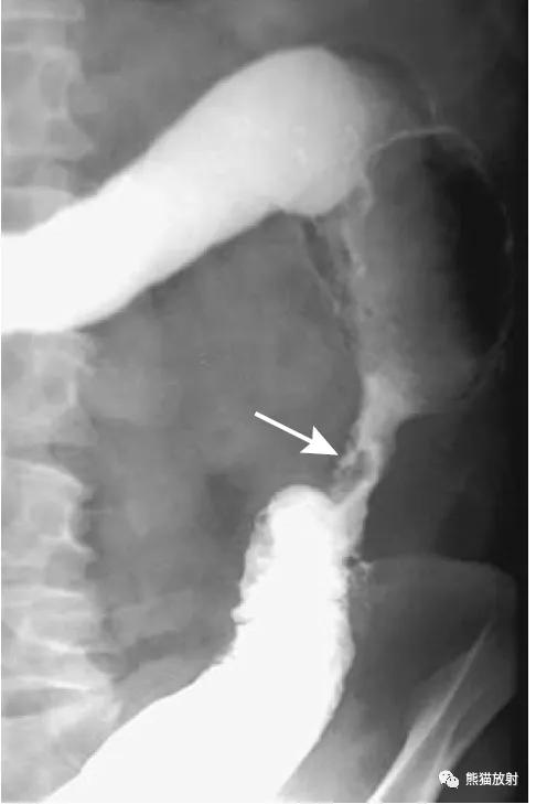 腹部影像图片大全,乙状直肠疼痛位置图片