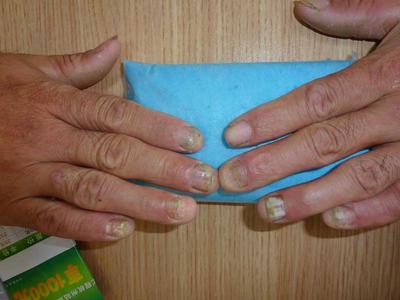 灰指甲治不好？如何防治顽固的皮肤真菌，关键三要素注意一下