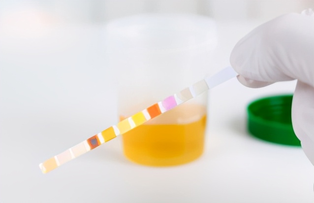 尿频？少尿？颜色异常？气味难闻？可能是4种疾病信号