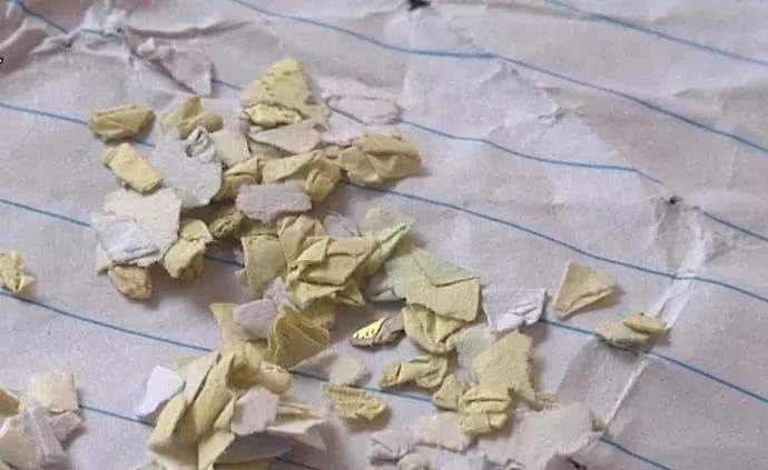 眼内异物巧取办法,眼内异物取出术操作步骤