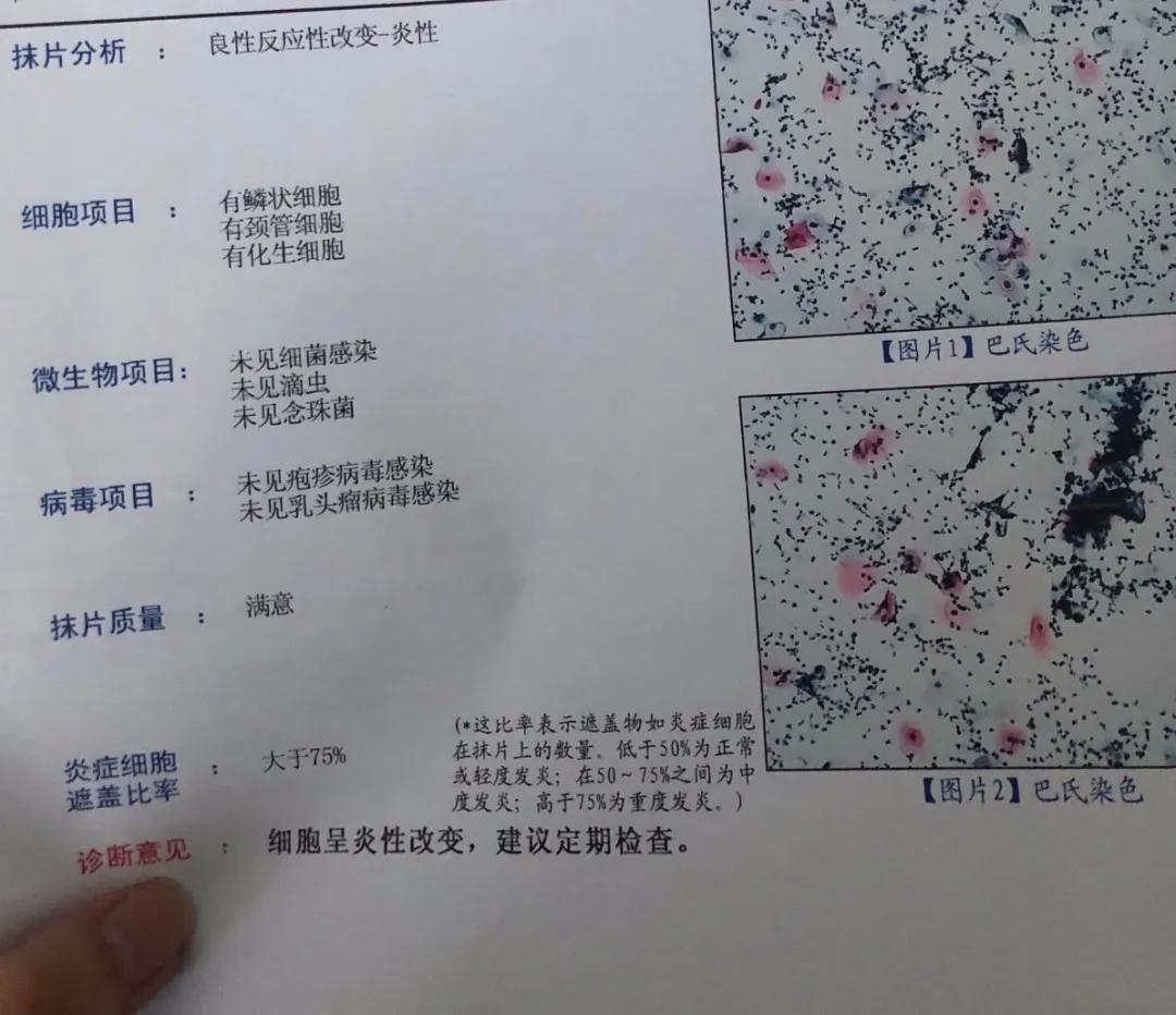 第一次去妇科检查需要注意什么,第一次产检妇科检查都有哪些项目