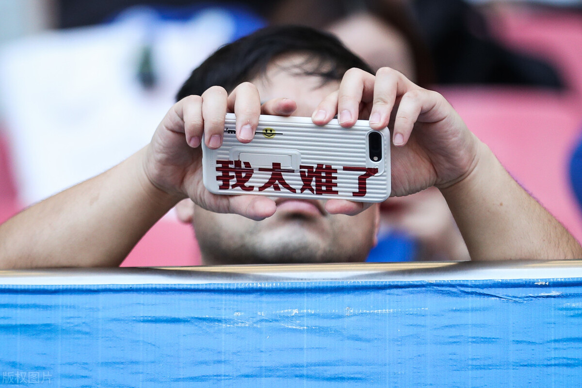 脱发也能脱出自己的风格