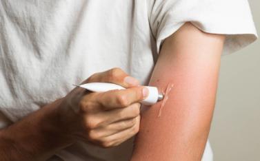 红霉素软膏用于眼睛会有什么后果,红霉素软膏对眼睛有什么副作用