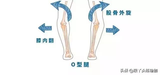 o型腿不好看怎么矫正,既能改善o型腿又能瘦腿的方法