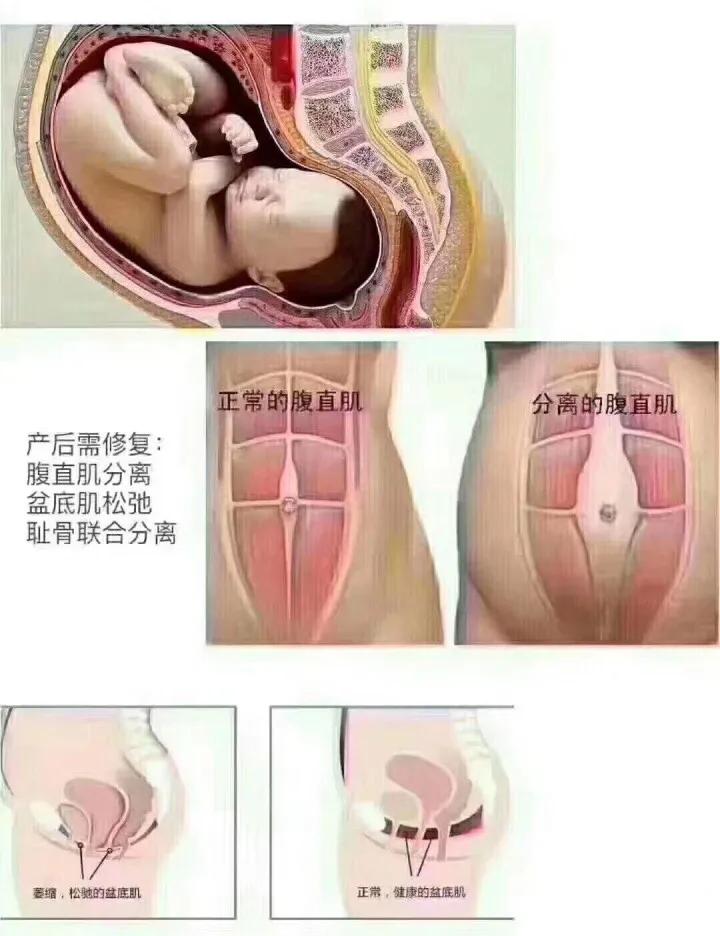 瑜伽解剖系列之腹直肌,产后修复、腰部赘肉、痛经相关肌肉