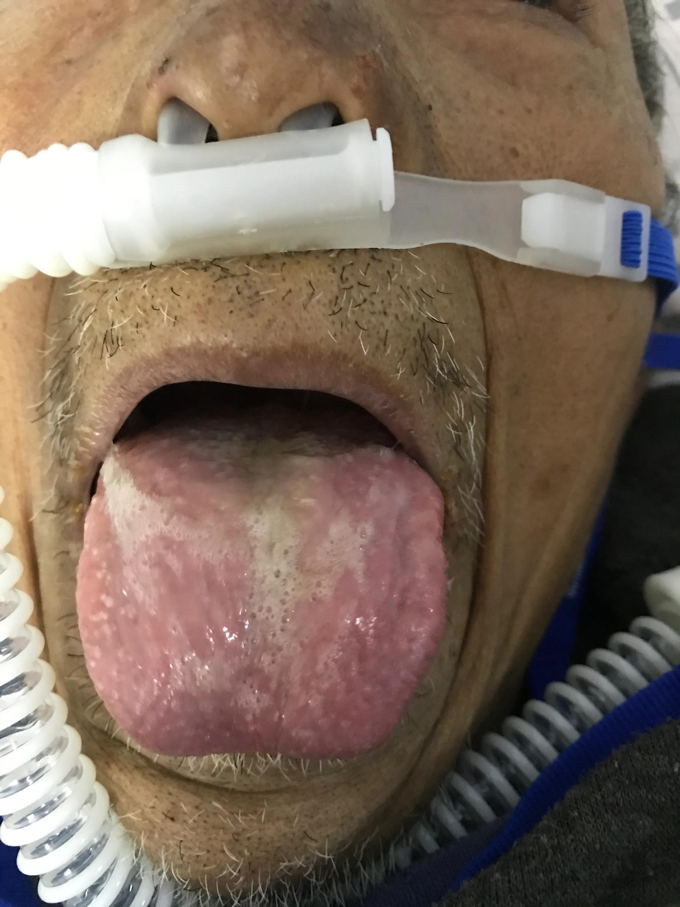 心室颤动患者的抢救首选,室上性心动过速急诊治疗