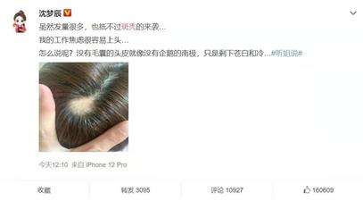 睡一觉起来全是头屑怎么回事,睡一觉起来头发秃了一块