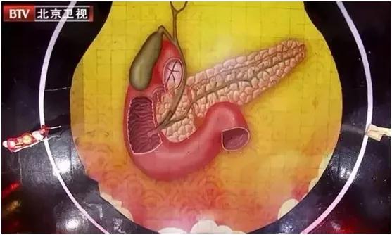 这5种炎症可能会演变成癌症,炎症发展成癌症的几率有多大