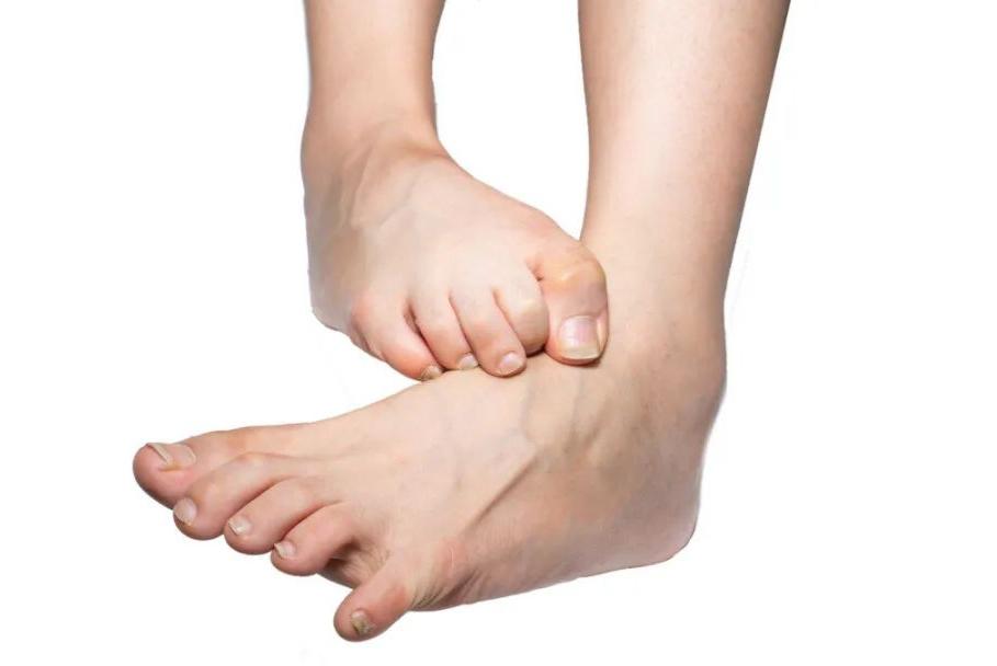 天气一热脚就脚臭？教你5招，远离脚气