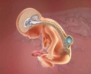 先天泌尿系统畸形能治好吗,注意缺陷多动障碍治愈