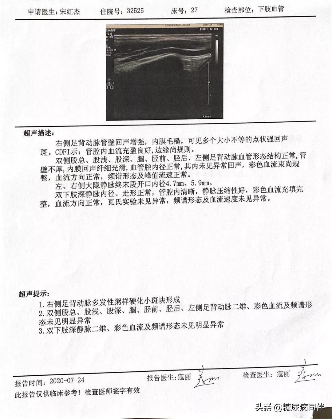 糖尿病新治疗方法逆转,糖尿病的自测与治疗