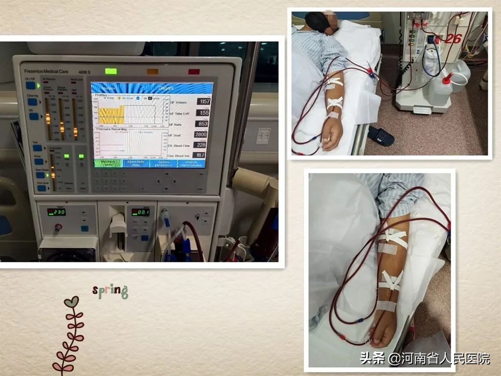 怎么防止肾功能衰竭,肾功能衰竭预防