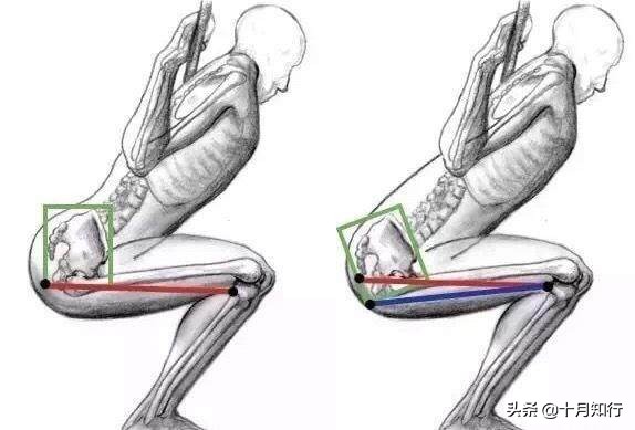髋关节运动知识点总结大全,髋关节功能锻炼操作流程