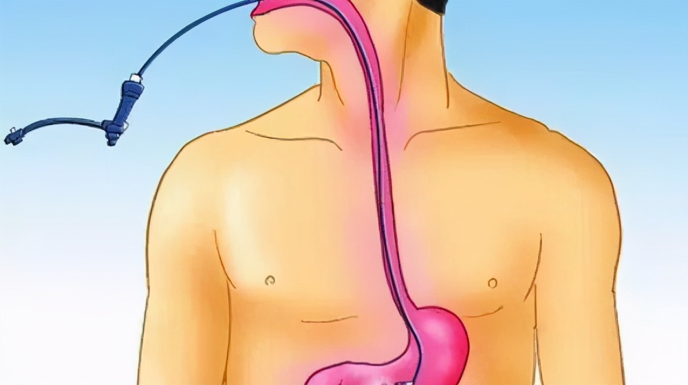 糖尿病人做肠胃镜检查该注意什么,肠胃镜检查前注意事项和饮食安全