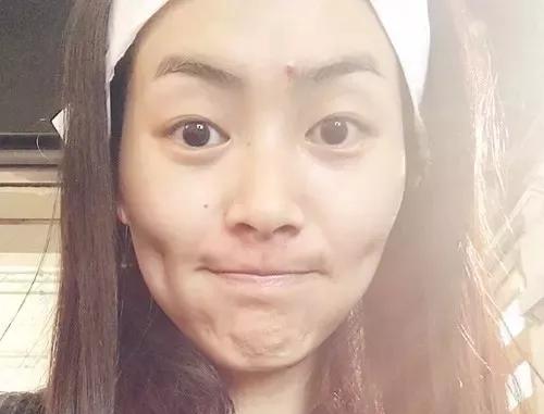 脸上老是长痘痘用什么药,脸上痘痘反复最快的解决方法