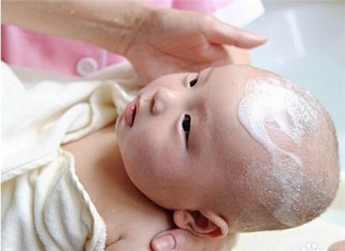 新生儿头上有疹子要剃头发吗,新生儿头上都有胎垢吗