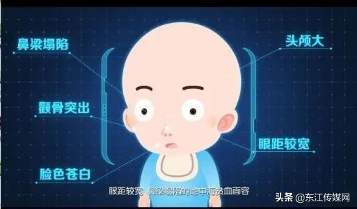 注意！这个病专宠广东人！结婚前一定要做这个检查