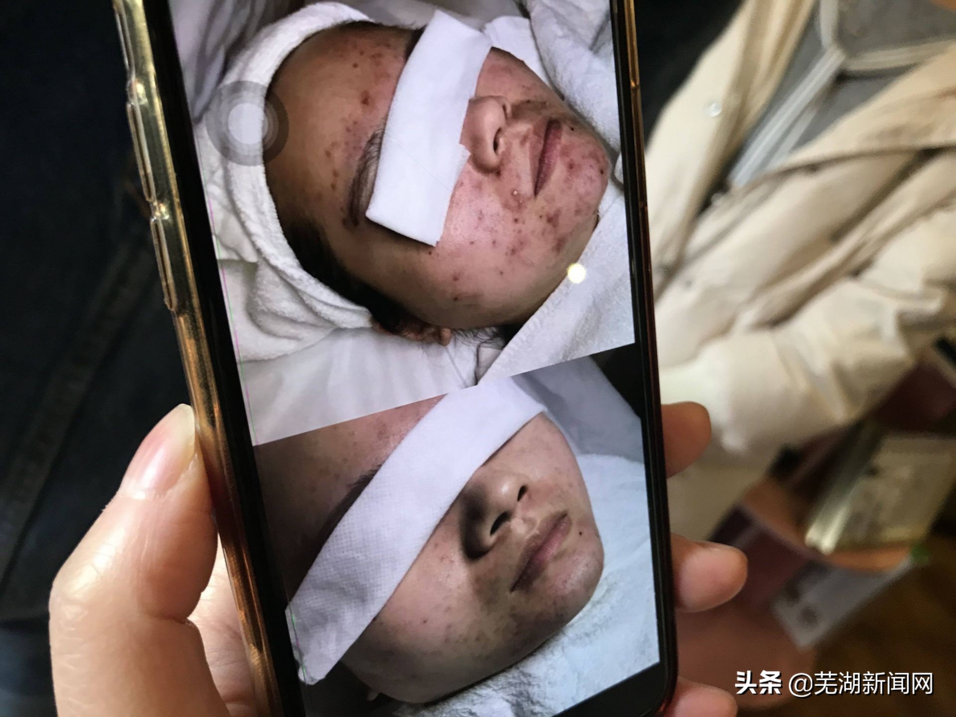 濂冲瓙绁涚棙閬獥4000,濂冲瓙绁涚棙琚獥