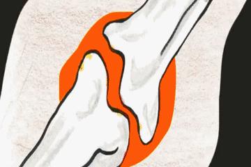 随便扭一扭感觉舒服怎么回事,运动时骨头关节咔咔响是什么原因