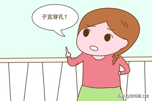 树袋宝宝：避孕环危害女性健康？一起来了解一下