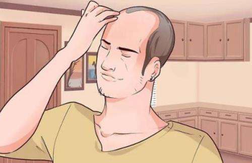 面对脱发如何自救,脱发的人自卑怎么调整心态