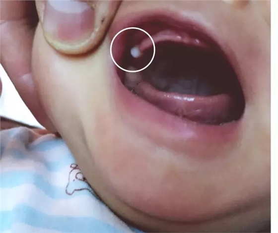 家有小宝贝,这几种特殊的生理现象不是病,家长不用太着急