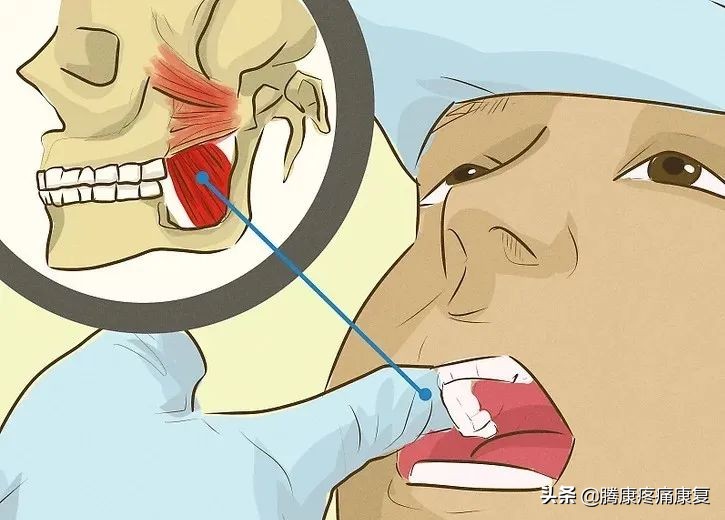 如何缓解紧张焦虑头痛,肌紧张性头痛的症状