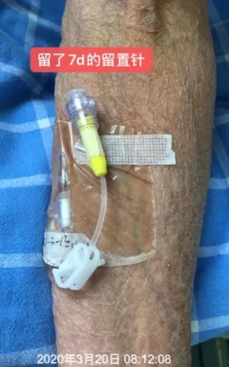 病人拒绝治疗护士怎么办,患者拒绝打留置针可以吗