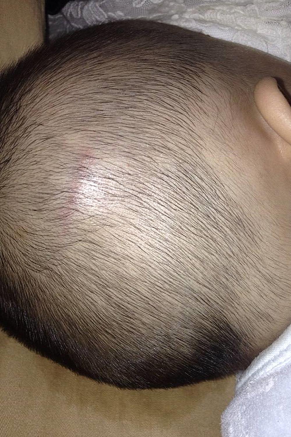 1岁的宝宝滑倒摔到后脑勺,一岁宝宝摔到头部怎么判断轻重