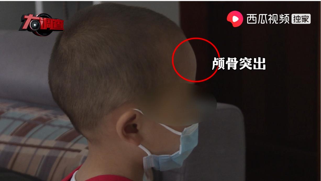 2003年大头娃娃假奶粉事件,大头娃娃假奶粉事件