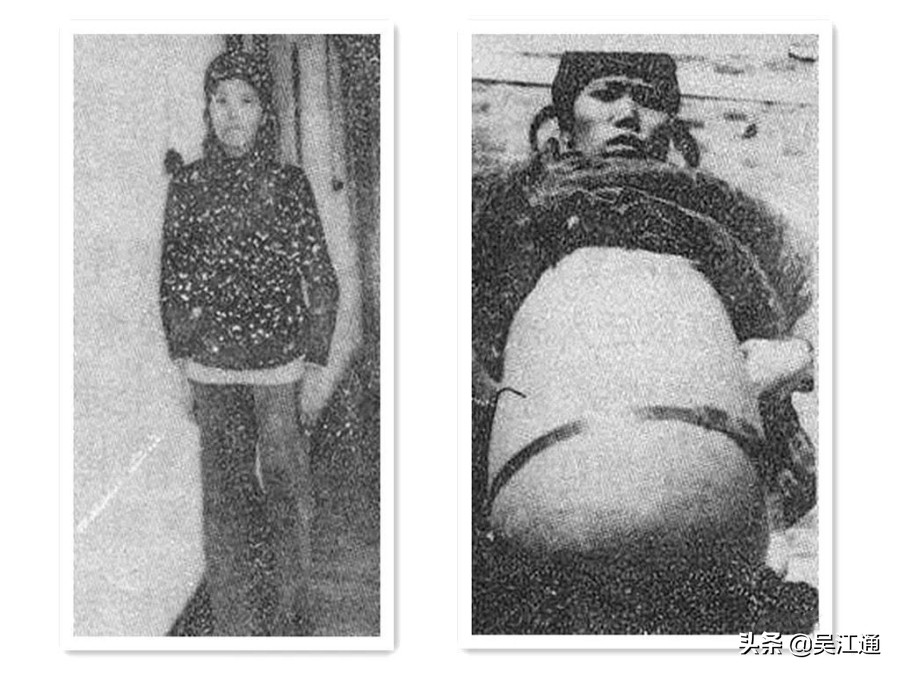 我经历“送瘟神”的时光