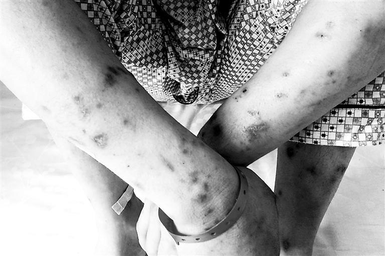 吸笑气吸到大小便*禁失**、把亲妈鼻梁打断....被*品毒**彻底毁掉的年轻人