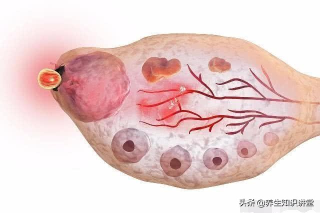 排卵期拉丝是排卵日后还是前,排卵期白带拉长丝是怀孕吗