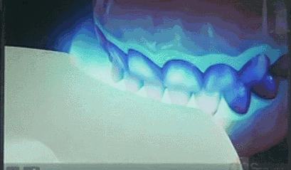 明星的美牙技巧有哪些呢,一口白牙女明星