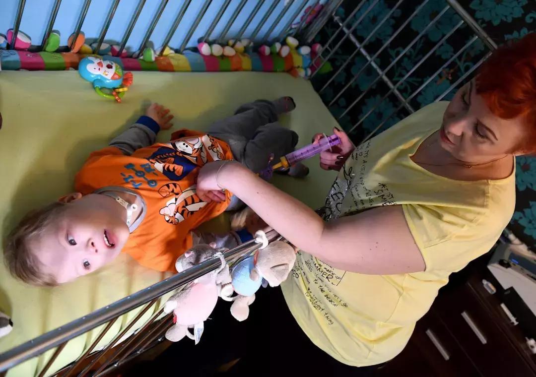 癫痫患儿救命药,婴儿癫痫痉挛性发作的激素疗法