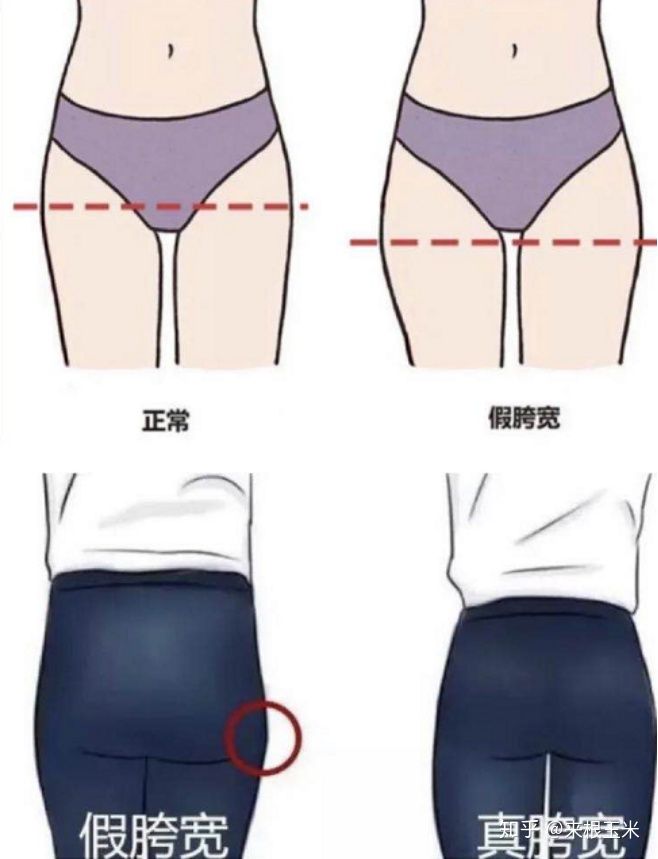 假胯宽、大象腿、脂肪腿，天生大粗腿的人该如何瘦大腿？