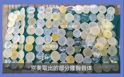 出现包膜挛缩可以修复吗,包膜挛缩如何修复