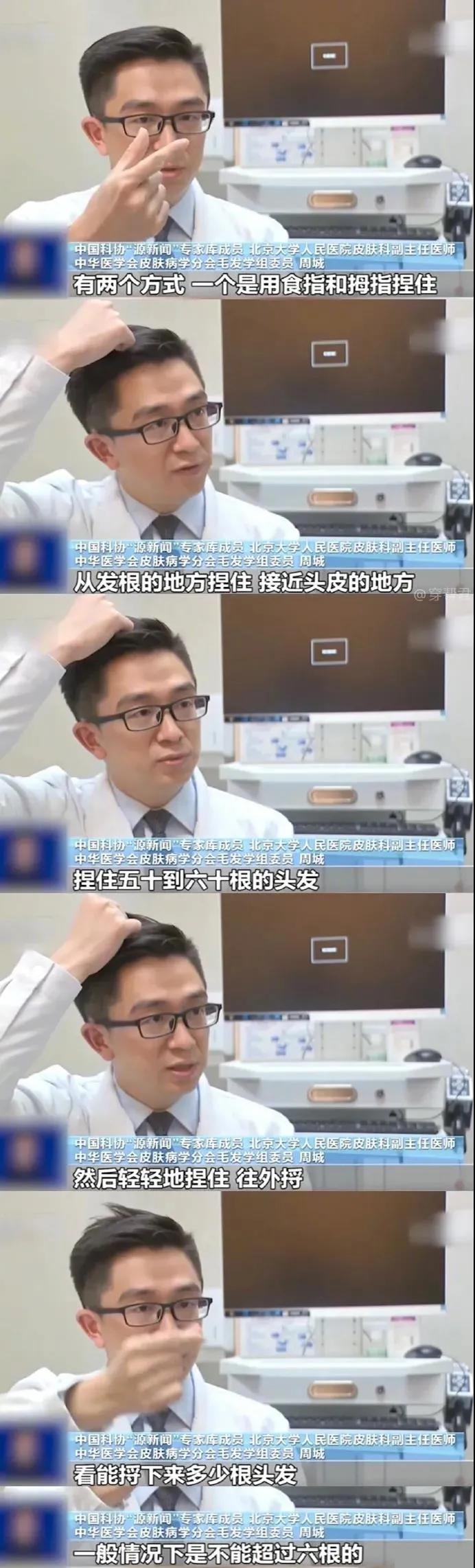 科研人员秃头,科研秃头人