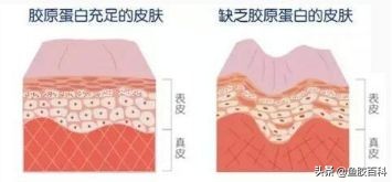 最有胶原蛋白的鱼胶,胶原蛋白含量高的鱼胶