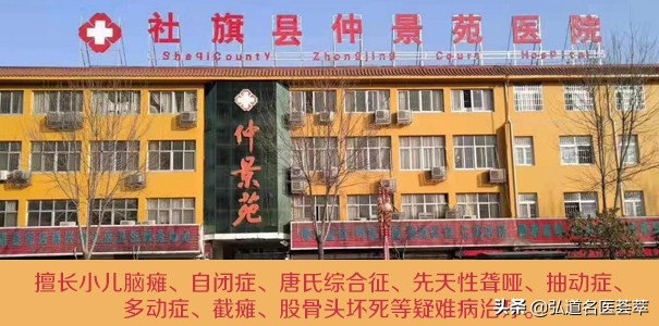 鍗楅槼娌荤枟灏忓効鑴戠槴涓撳,寮犲厠鍖荤敓涓尰