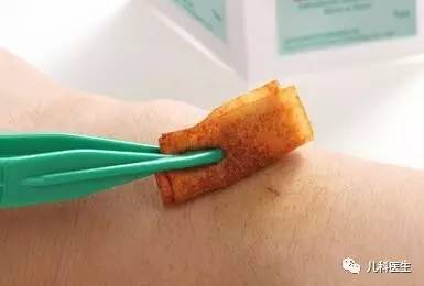 碘伏可以涂在伤口会有色素沉着吗,碘伏消毒伤口后容易留疤吗